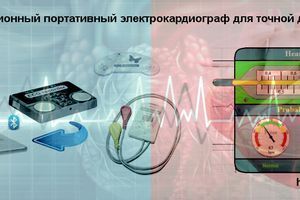 Фазаграф: інноваційний портативний електрокардіограф для точної діагностики серця фото