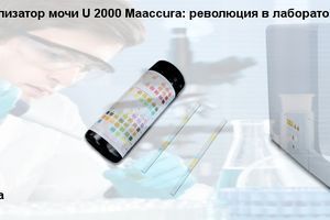 Автоматичний аналізатор сечі U 2000 Maaccura: революція у лабораторній діагностиці фото