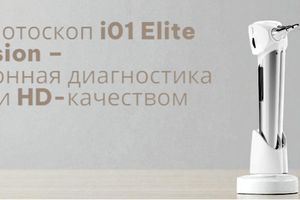 Цифровий отоскоп i01 Elite від SyncVision &ndash; інноваційна діагностика вуха з WiFi та HD-якістю фото