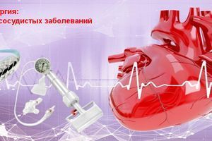 Эндоваскулярная хирургия: революция в лечении сосудистых заболеваний фото