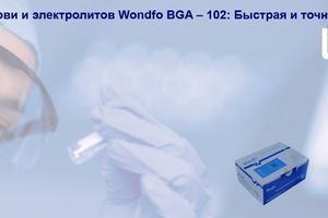 Аналізатор газів крові та електролітів Wondfo BGA &ndash; 102: Швидка та точна діагностика фото
