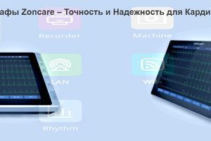 Електрокардіографи Zoncare &ndash; Точність та Надійність для Кардіодіагностики фото