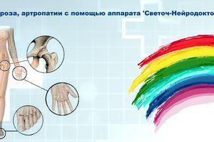 Лікування артриту, артрозу та артропатії за допомогою апарату "Світоч-Нейродоктор" фото