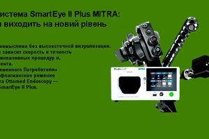 Видеоэндоскопическая система SmartEye II Plus MITRA: Точность диагностики выходит на новый уровень фото