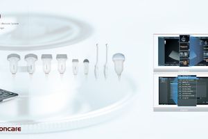 Портативна система ультразвукової діагностики Zoncare M30 фото