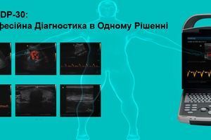 УЗД апарат Mindray DP-30: Мобільність та Професійна Діагностика в Одному Рішенні фото