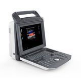 Портативная система ультразвуковая диагностическая Zoncare M5 Zoncare M5 фото