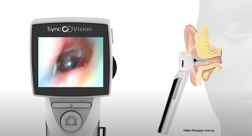 Цифровий отоскоп SyncVision i01 Elite 5247 фото