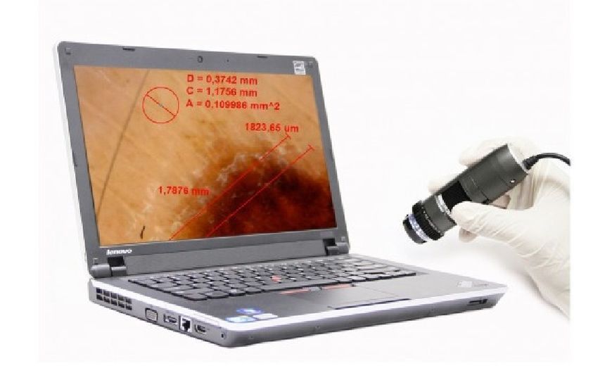 Цифровий дерматоскоп DermaScope POLARIZER HR 200x (MEDL7DM) Dino-Lite MEDL7DM фото