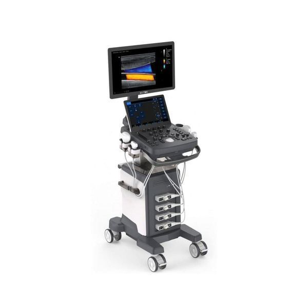 Zoncare ViV 40 ультразвукова діагностична система Zoncare ViV 40 фото