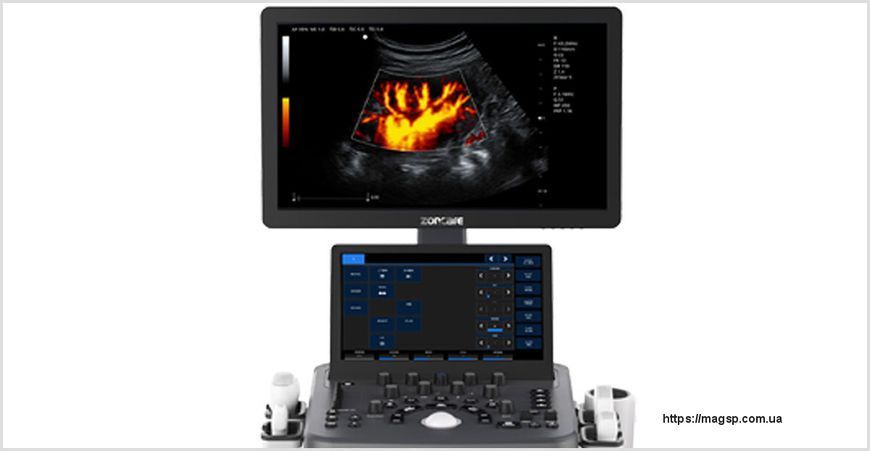 Zoncare ViV 40 ультразвукова діагностична система Zoncare ViV 40 фото