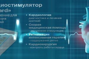 Електрокардіостимулятор ЧСЕКС "StiCard": інноваційне рішення для діагностики та лікування серцевих патологій фото