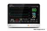 Монитор пациента Mindray ePM15 Mindray ePM15 фото