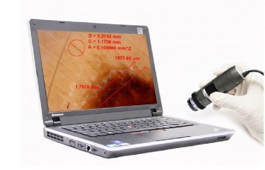 Дерматоскоп цифровий DermaScope POLARIZER HR MEDL7DW, Dino-Lite 202Е фото