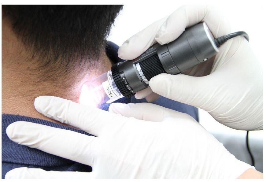 Дерматоскоп цифровий DermaScope POLARIZER HR MEDL7DW, Dino-Lite 202Е фото