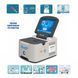 Анализатор газов крови и электролитов BGA-102 WONDFO BGA-102 фото 4